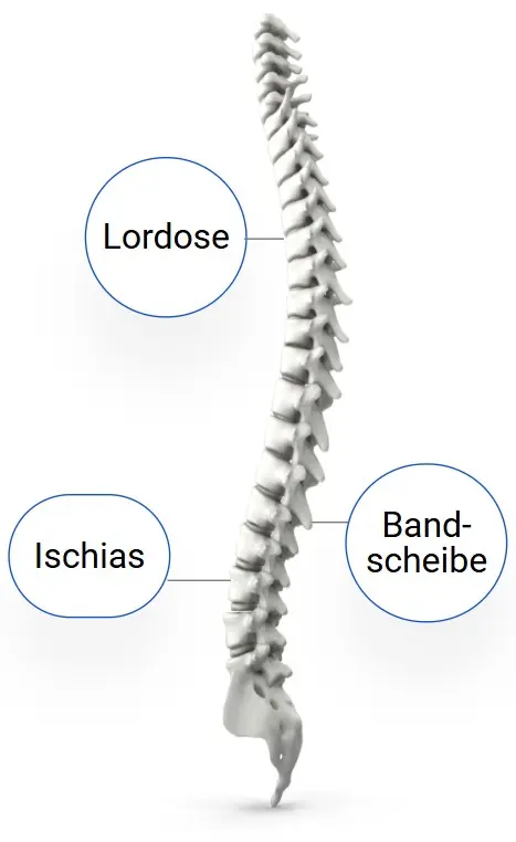 Wirbelsäule mit Beschriftungen